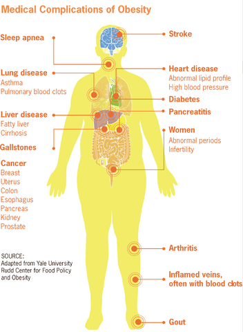 health risks of fat tummy