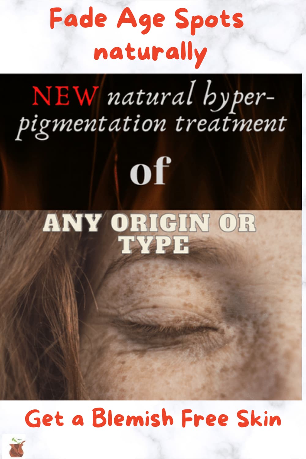 Natural age spots remover