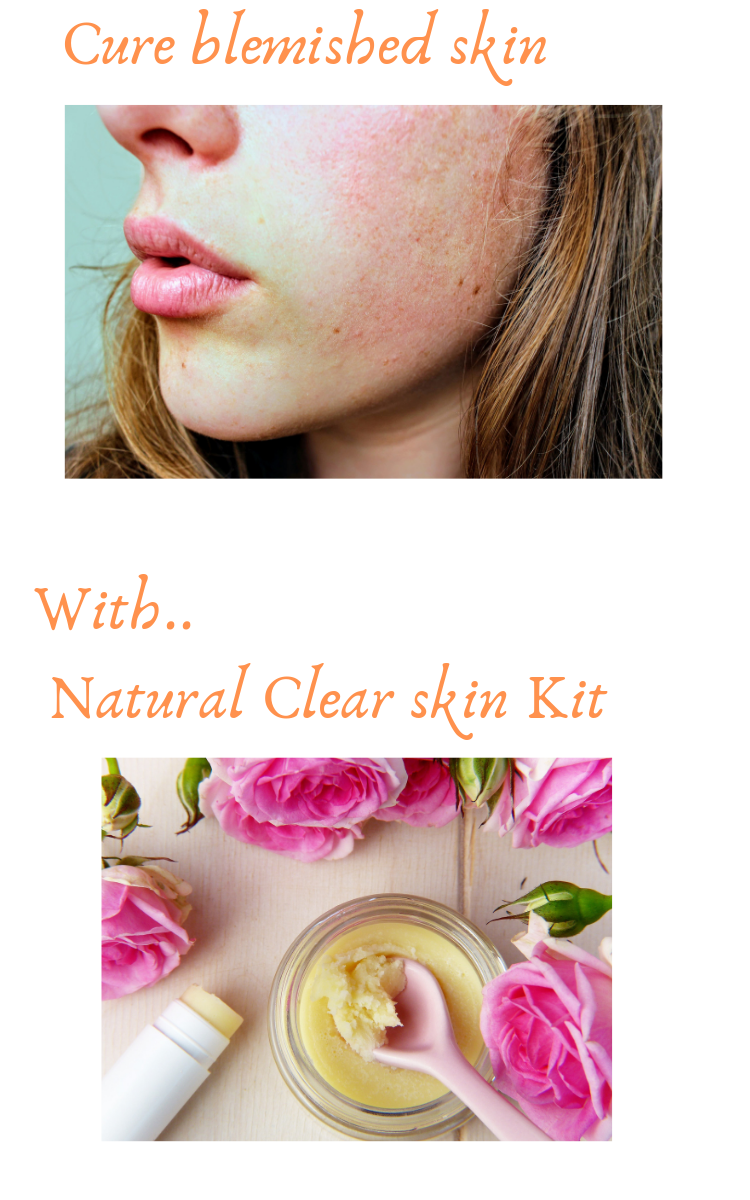 How to clear your skin of blemishes acne scars and blotches naturally