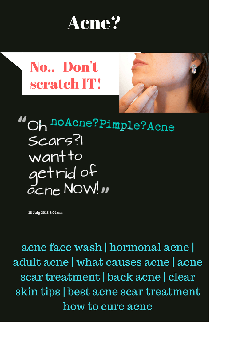 How to get rid of acne and acne scars-and get a blemish free skin without dangerous chemicals